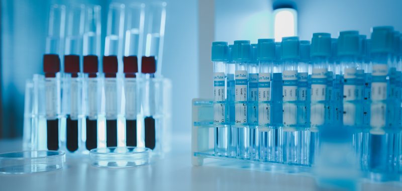 El uso de la IA en las pruebas periciales